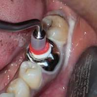 CROWN -O-PRESS DDI