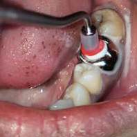 CROWN -O-PRESS DDI