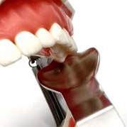3rd Molar Retractor DDI