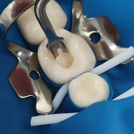 Con Contact-Sculpt DDI