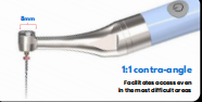 Smart Endo Mini DDI