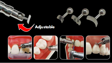 Gingival Sheild-DDI