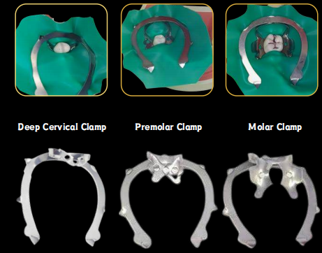 Smart Clamps DDI