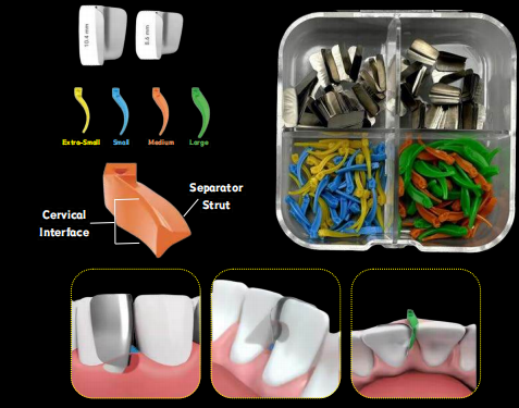 Matrix Master Kit (Anterior)-DDI
