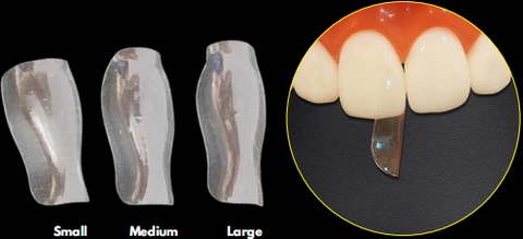 Trans Anterior Matrix DDI