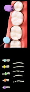 Endo Matrix (Quick Pre Endo Bildup) DDI