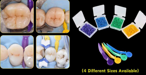 Anatomical Wedges With Hole DDI