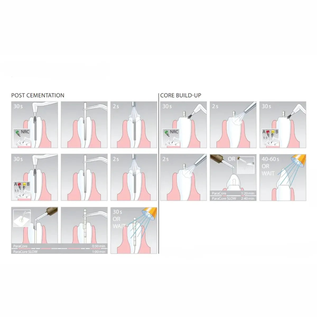 Coltene Paracore Kit