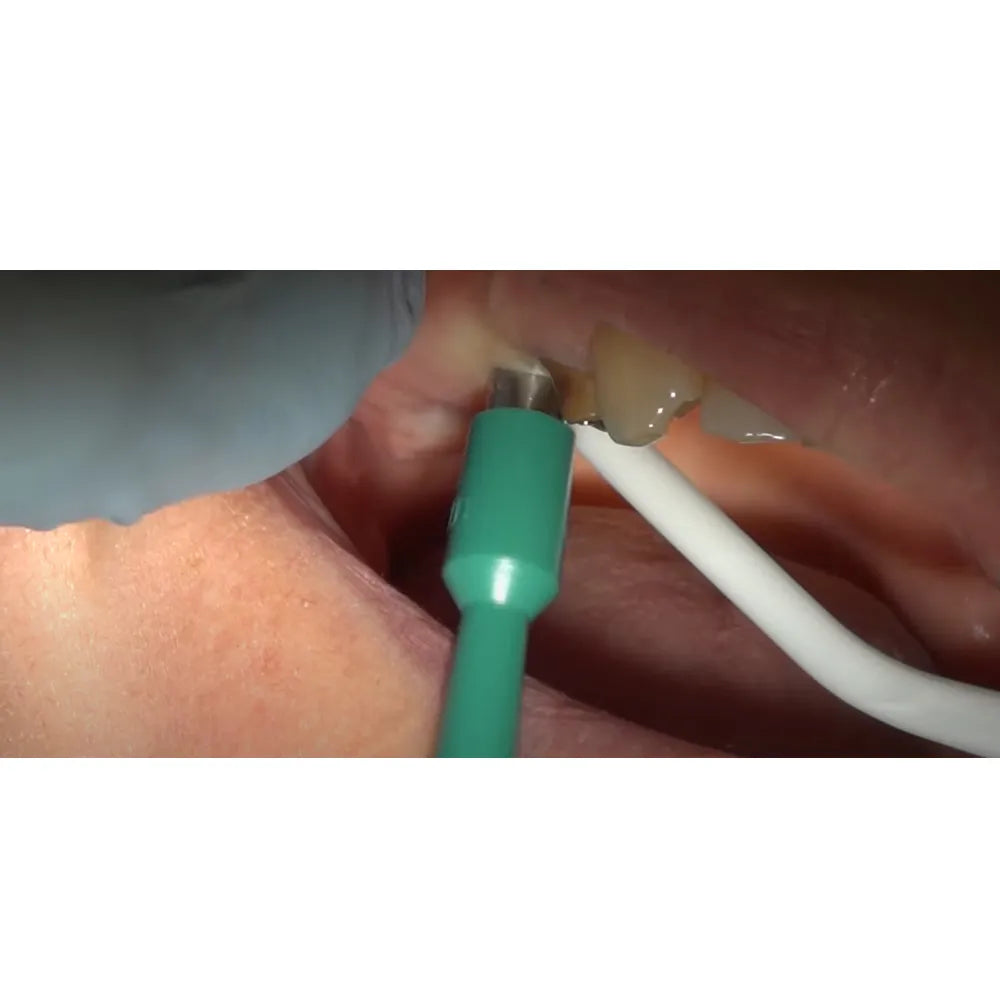 Implant Tissue with Punch Positioner DDI